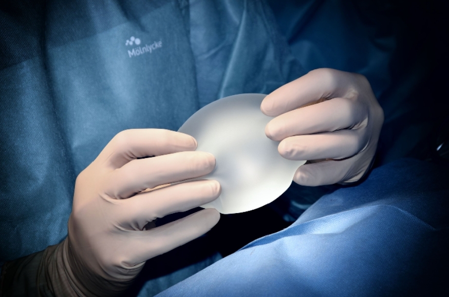 Choosing the Perfect Breast Implant: What Factors Should You Consider?